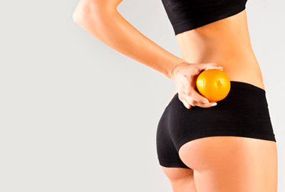 Cellulite hoe kom je daar nou vanaf ?